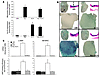 Myocardin and KLF4 exert opposing influences over SMC gene expression in tr