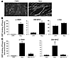 Myocardin and KLF4 exert opposing influences over SRF binding to SMC genes