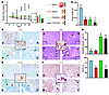 Antitumoral action of combined mTORC1 and MAPK inhibition in vivo.