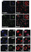 STXBP5 is present in platelets.