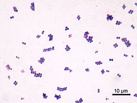 Staphylococcus aureus com técnica de Gram