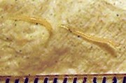 Oxyuridae Pinworm