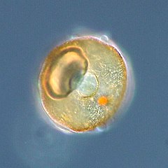 Shell or test of a testate amoeba, Arcella sp.