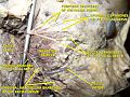 Lateral head anatomy detail. Neonatal dissection.