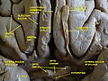 Cerebrum, inferior view, deep dissection.