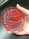 Culture of S. aureus