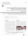 Research paper thumbnail of Dermoscopic and reflectance confocal microscopic findings in a case of plasma-cell cheilitis