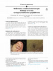 Research paper thumbnail of Reflectance confocal microscopic findings of a tiny syringocystadenoma papilliferum