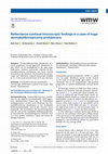 Research paper thumbnail of Reflectance confocal microscopic findings in a case of huge dermatofibrosarcoma protuberans