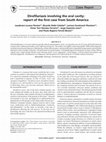 Research paper thumbnail of Dirofilariasis involving the oral cavity: report of the first case from South America