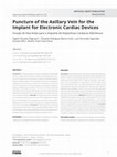 Research paper thumbnail of Puncture of the Axillary Vein for the Implant for Electronic Cardiac Devices