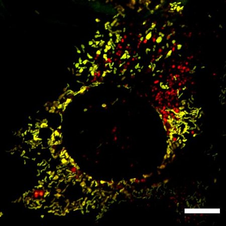 Chan-Mitophagy-NEWS-WEB