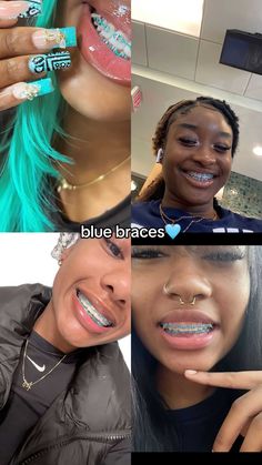 Braces Colors Hot Pink, Turquoise Braces, Royal Blue Braces, Teal Braces, Pretty Braces, Braces Colors Combinations, Blue Braces, Braces Colors Ideas, Sweet Quotes For Boyfriend