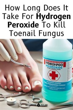 How long does it take for hydrogen peroxide to kill toenail fungus Nail Fungal Infection Toenails, Thick Toenail Remedy, Ugly Toenails, Toenail Problems, Antifungal Cream