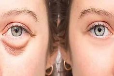 two people with different colored eyes looking in the same direction