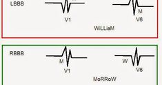 two diagrams showing the different voltages in an electrical circuit, with one on each side and