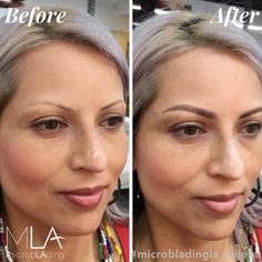 These brows were created by Master Artist Julie Ha! She's co-teaching a combo class with Lindsey. Check it out: https://microbladingla.com/microblading-plus-shading-combo-class/?utm_content=bufferf6630&utm_medium=social&utm_source=pinterest.com&utm_campaign=buffer Combination Brows, Brows Done, No Brows, Brows Microblading, Licensed Esthetician, Co Teaching, Beautiful Eyebrows, Semi Permanent Makeup, Eye Brows