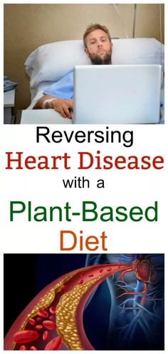 Man Refuses Surgery after Googling Diet for Reversing Heart Disease | EatPlant-Based Foods For Heart Health, Unclog Arteries, Infrarot Sauna, Vegan Tips, Health Heart, Cholesterol Remedies, Cardiac Nursing