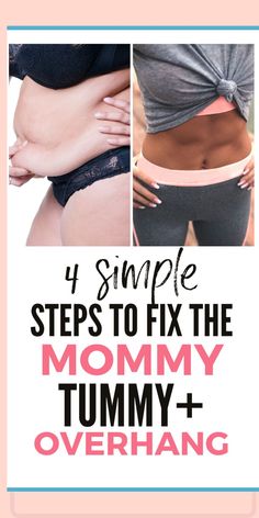 4 steps to fix the mommy tummy and overhang Sagging Belly, Mom Tummy, Tummy Pooch, Mommy Pooch, Losing Mom, Mom Belly