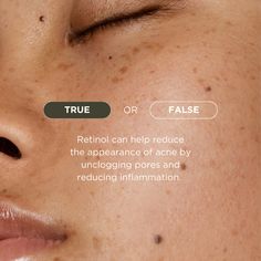 True Or False Skincare Edition, Did You Know Post Design Ideas, Skin Facts, Esthetician Marketing, Instagram Branding Design, Skin Advice, Skin Aesthetics, Social Media Branding Design, True Or False