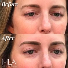 Look at these amazing eyebrows by Julia Faria! 😍 #microblading #pmu Permanent Eyebrows, Permanent Makeup, Little Sisters, Look At