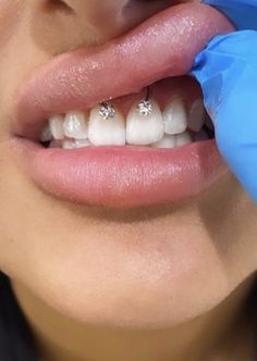 a woman is getting her teeth brushed by an electric toothbrush with blue gloves on