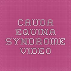 Cauda Equina Syndrome Video Severe Lower Back Pain, Emergency Medicine, Low Back Pain, Nerve, Life Changing, Chronic Pain, Low Back