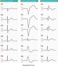 Telemetry Technician, Study List, Nursing Cardiac, Cardiac Rehab, Cardiology Nursing