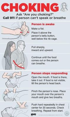 Heimlich Maneuver, First Aid Cpr, First Aid Tips, Emergency First Aid, Survival Skills Life Hacks, Medical School Essentials, Survival Life Hacks, Survival Techniques, Apocalypse Survival