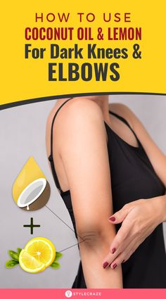 How To Lighten Knees, Lighten Knees, Dark Knees, Dry Elbows, Dark Elbows, Tan Removal, Dark Underarms, Tips For Skin, Remove Dark Spots