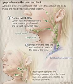 Lymph Vessels, Facial Plastic Surgery, Facial Plastic