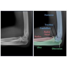 an x - ray view of the foot and ankle with different types of bones labeled