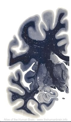 an image of the inside of a human brain with black and white images on it