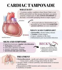 the heart and lungs are labeled in this diagram, which is what they look like