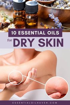 Skin Oil Recipe, Essential Oils For Dry Skin, Dry Skin On Face, Skin Care Lotions, Skin Oil, Cream For Dry Skin