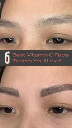 Transform your oily skin with these 6 amazing vitamin C toners. Get ready for a glowing, balanced complexion! #SkincareLovers #VitaminC #OilySkinCare Oily Skin Care