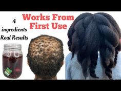 how to get long hair, long hair, hair growth, get long hair, fast hair growth, how to grow long hair, hair growth tips, hair growth oil for fast hair growth, long hair fast, hair shampoo for hair growth, grow hair fast, rice water for hair growth, hair growth shampoo, how to grow hair fast, grow hair faster, grow long hair, coffee shampoo for hair growth fast, coffee shampoo for fast hair growth, coffee shampoo for fast hair growth at home Hair Growing Recipes, Naturally Darken Hair, Diy Hair Growth Spray, Darken Hair, Help Hair Grow Faster