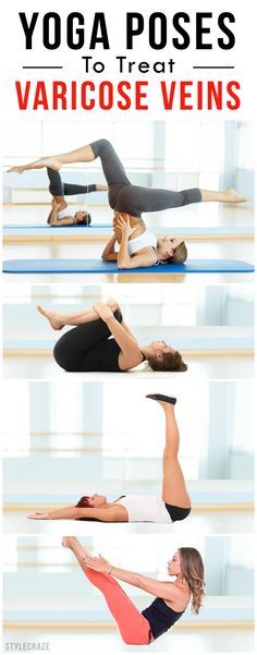 yoga poses to treat varicose veins and reduce pain in the lower back