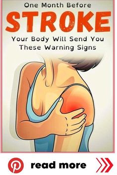 Months Before a Stroke, Your Body Will Send You These Warning Signals! What Is Health, Healthy Living Inspiration, Health Signs, Health Management, Healthy Lifestyle Tips, Signs And Symptoms, Holistic Wellness, Health Advice, Health Facts