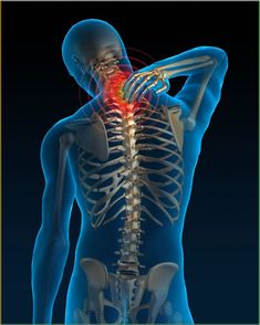 Neck Pain – Cervical Spondylosis and other degenerative disc diseases – Treatment - Mobilization Exercises Stiff Neck Remedies, K Tape, Cervical Spondylosis, Stiff Neck, Spine Surgery, Power Trip, Sciatic Nerve Pain, Neck Pain Relief, Mobility Exercises