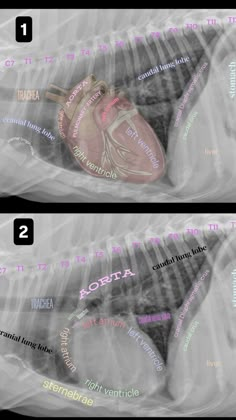 an image of the human heart labeled in different languages