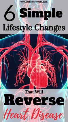 Want to know how to reverse heart disease ? Well it's possible!  As a medical doctor, chronic diseases make up the majority of cases that doctors see on a regular basis. But what most don't know is that these diseases are lifestyle related, meaning you can change the outcome!  Read to know the 6 proven lifestyle changes that will reverse heart disease  and other chronic diseases. #heartdisease #reverseheartdisease #preventandreverseheartdisease #hearthealthydiet #hearthealth Bad Lifestyle, Healthy Living For Beginners, Foot Reflexology Massage, Healthy Heart Tips, Heart Healthy Diet, Lower Your Cholesterol, A Daily Routine, Simple Lifestyle, Healing Touch