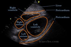 Echo Sonography, Echo Show 8 Tips, Ultimate Echo Echo, Ultrasound Sonography, Vet Medicine