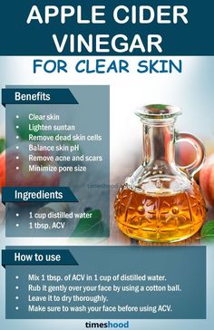 Acv On Face, Get Clear Skin Naturally, For Clear And Glowing Skin, Apple Cider Vinegar Remedies, Clear And Glowing Skin, Clear Skin Naturally