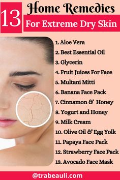 13 Home Remedies For Extremely Dry Skin Skin Care For Winter Dry Skin, Extremely Dry Skin Remedies, For Dry Skin Remedies, Severe Dry Skin Remedies, Very Dry Skin Remedies, Dry Skin Remedies For Face Home Made, For Dry Skin, Best Soap For Dry Skin, Extremely Dry Skin On Face