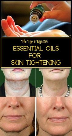 Get Rid Of Saggy Skin, Diy Skin Tightening, For Skin Tightening, Top Essential Oils, Oil Uses, Sagging Skin