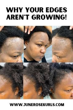 How To Grow Hair Edges Back Fast, Natural Hair Edges Growth Tips, African Hair Products For Hair Growth, Edge Growth For Natural Hair, Hers Hair Growth, Edges Growth For Natural Hair, Hair Edges Growth Tips, Growing Edges Back Hair Natural, Regrow Edges Natural Hair