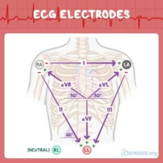 Emt Notes, Ekg Nursing, Cardiology Notes, Study Playlist, Nclex Study Plan, Ekg Interpretation, Lab Assistant, Pediatric Nurse Practitioner, Medical Study