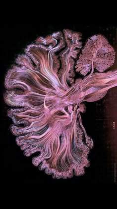 an image of the inside of a human brain, with pink and purple lines on it