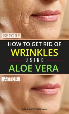 Aloe Vera For Face, Get Rid Of Wrinkles, Fitness Hacks, Healthy Advice, Facial Hair Removal, Anti Aging Skin